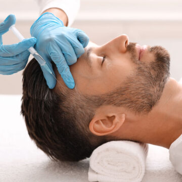Beyond Aesthetics: PRP for Hair Restoration with The X – Beauty Lounge Bali’s Vampire Facial
