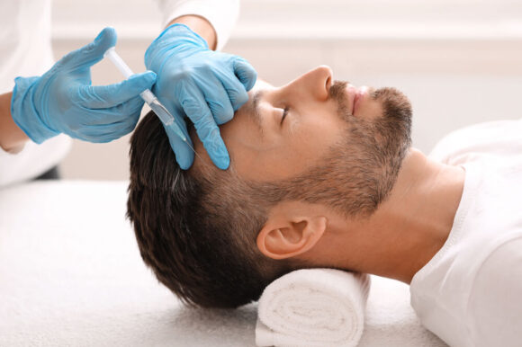 Beyond Aesthetics: PRP for Hair Restoration with The X – Beauty Lounge Bali’s Vampire Facial