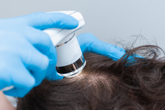 Hair & Scalp Revival